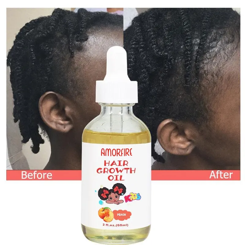 Amórfire óleo doce de amórdoce vitamina e, fechadura, umidade, crianças, óleo de crescimento de cabelo para bebês 60ml