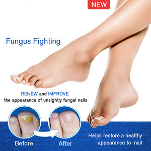 LANTHOME 4ml Perawatan Anti Jamur Kuku Pena Perbaikan Kuku untuk Onikomikosis Paronikia Infeksi Jamur Kuku Jari Tangan dan Kaki - Product Image 5