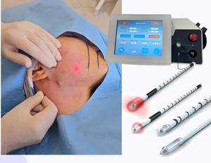 Máquina láser quirúrgica médica aprobada por CE, proctología, hemorroides, 980nm, 1470nm, <span class=keywords><strong>proctoscopia</strong></span>, cirugía de fisuras para venas varicosas - Product Image 3