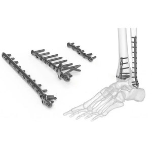 Instruments chirurgicaux pour traumatismes, instruments chirurgicaux orthopédiques réutilisables en acier inoxydable de haute qualité pour usage hospitalier et clinique - Product Image 1