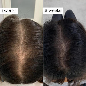 Sérum Natural de Crescimento Capilar com Óleo de Argan Herbal, Biotina e GHK-CU Cobre, Essência Anti-Queda e Regeneradora - Product Image 5