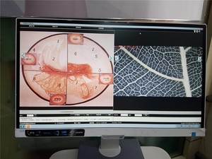 KN-2200B Kernel CE Harga koloskop disetujui Harga Video optik portabel mesin colposkopik teropong colposkopik - Product Image 5