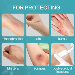 ฟิล์มใสติดสายสวนสำหรับฉีดแผลแผ่นฟิล์มตกแต่ง - Product Image 6