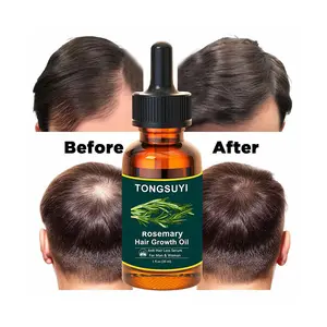30ml China Suppliers Wholesale Personal Care Hair Nourishing Essential Organic Oil Serum Hair Growth Oil