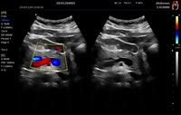 Échographe vétérinaire couleur Doppler 4D de 15,6 pouces, système d'échographie et accessoires d'échographie - Prix