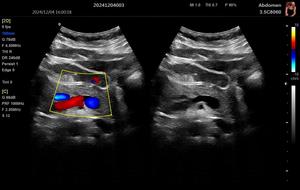 Échographe vétérinaire couleur Doppler 3D de 15,6 pouces, système d'échographie et accessoires d'échographie, <span class=keywords><strong>prix</strong></span> - Product Image 5