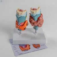 KyrenMed glande thyroïde et modèle pathologique Modèle de la glande thyroïde et des pathologies