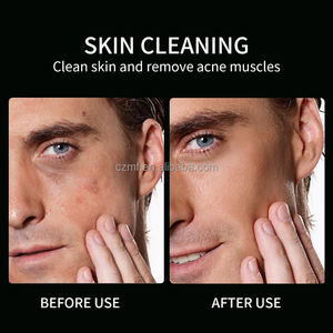 Private Label naturale biologico riparazione <span class=keywords><strong>Anti</strong></span> <span class=keywords><strong>Acne</strong></span> sbiancante idratante olio di controllo restringe pori cura della pelle Set per gli uomini - Product Image 5