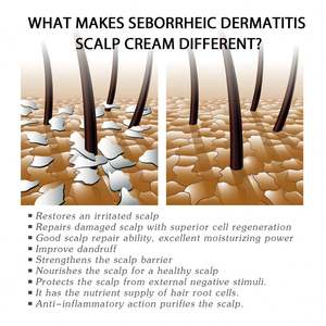 Crème de soin du <span class=keywords><strong>cuir</strong></span> <span class=keywords><strong>chevelu</strong></span> South Moon, crème nettoyante, hydratante et réparatrice pour le <span class=keywords><strong>cuir</strong></span> <span class=keywords><strong>chevelu</strong></span>, soulagement des démangeaisons et de l'eczéma, soin topique - Product Image 5