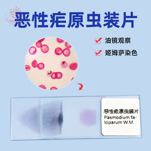 Portaobjetos con preparado de Plasmodium vivax, patología, diflujo sanguíneo, parásito médico, película sanguínea gruesa y fina, coloración con Giemsa. - Product Image 5