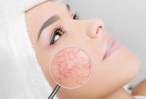 Germany Laser EVLT multifuncion lipolysis quirurgica 980 liposuction laser maquina laser vascular diodo laser 1470nm Endolaser - Product Image 2