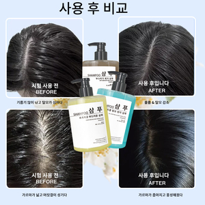 Shampoo à la Rosmarine Cheveux Doux et Volumineux Croissance des Cheveux Traitement Hydratant du Cuir Chevelu <span class=keywords><strong>Anti</strong></span>-Sécheresse Huile <span class=keywords><strong>Anti</strong></span>-Démangeaisons <span class=keywords><strong>Pellicules</strong></span> Cheveux Abîmés Utilisation Domestique Gratuit - Product Image 5