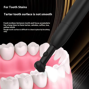 Détartreur électrique multifonctionnel pour le blanchiment <span class=keywords><strong>des</strong></span> dents Polisseuse de dents en plastique pour enlever la plaque de tartre Instrument dentaire - Product Image 6