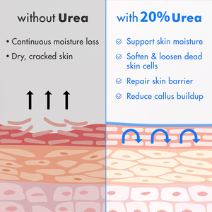 Crema per la Cura dei Piedi con 0,5% di Vitamina E e 20% di Urea, Idratante, Sbiancante, Rimuove la Pelle Morta, Ripara le Funzioni Fungine, Previene Secchezza e Screpolature - Product Image 6