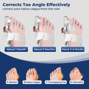 Séparateur d'orteils pour <span class=keywords><strong>hallux</strong></span> <span class=keywords><strong>valgus</strong></span> en gel avec ajusteur pour soulager la douleur du bunions et aligner efficacement les orteils - Product Image 4