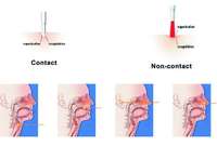 Système laser à diode bleue portable Dimed Berylas 10W 445nm pour la chirurgie ORL |   Appareil ORL refroidi par air certifié CE