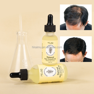 Aceite indio para el crecimiento del cabello para hombres y mujeres, tratamiento capilar, aceite herbal anticaída, aceite indio para el crecimiento del cabello - Product Image 1