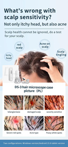 Portable Advanced Hair Loss Analyzer with Scalp Care Function for Home and Salon Skin Diagnosis Lenses Detailed Scalp Analysis - Product Image 3