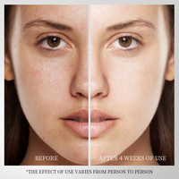Crème éclaircissante à la niacinamide MOOYAM en marque propre, crème anti-taches, élimine le mélasma, les taches brunes, éclaircit la peau, crème éclaircissante pour le visage