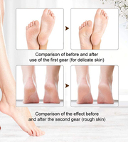 Outils de soin des pieds Machine électronique d'élimination des callosités des pieds Removedor De Callos Élimination des peaux mortes Meuleuse de pieds électrique