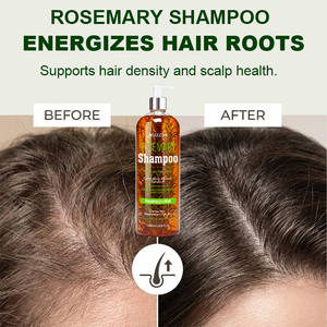 Champú Nutritivo de Romero Natural para Control de Grasa, Frescura Duradera, Engrosamiento y Crecimiento del Cabello - Product Image 5