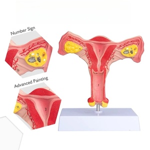 ขนาด<span class=keywords><strong>ธรรมชาติ</strong></span>แบบจำลองทางกายวิภาคของมดลูกหญิง - Product Image 3
