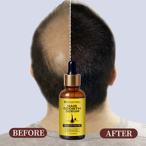 Tratamiento OEM ODM de Rápida Absorción para el Crecimiento del Cabello y Anticaída, Suero para el Crecimiento del Cabello - Product Image 2