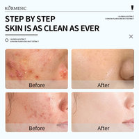 Kormesic 30ml Vente en gros de gel hydratant nourrissant réduit les boutons anti-acné apaisant et réparateur contre l'acné