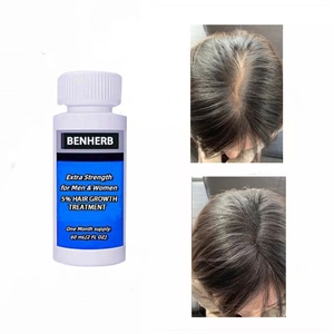 5% Hữu Cơ giải pháp tại chỗ 60ml nhãn hiệu riêng điều trị tăng trưởng tóc tóc mọc lại dầu đại lý ngăn ngừa rụng tóc sử dụng nhà Unisex - Product Image 2