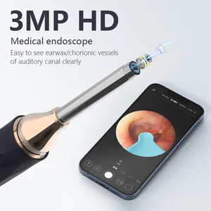 2023 מפעל OEM ODM אוזן הסרת כפית Led אורות אלחוטי Otoscope חשמלי חזותי אוזן שעווה ערכה לניקוי