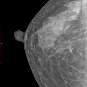 医療機器10 "* 12" ワイヤレスデジタル乳房フラットパネル検出器X線DRフラットパネル検出器マンモグラフィ検出器 - Product Image 6