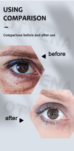 OTVENA <span class=keywords><strong>Crème</strong></span> Contour des Yeux <span class=keywords><strong>Anti</strong></span>-Âge 8ml à Effet Instantané, Raffermissante, Hydratante, Réparatrice des Cernes et des <span class=keywords><strong>Rides</strong></span>, à base de Peptides – Meilleure Vente - Product Image 6