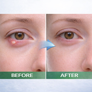 Sérum pour les <span class=keywords><strong>yeux</strong></span> Stye, acide hyaluronique, traitement anti-âge apaisant pour les <span class=keywords><strong>yeux</strong></span>, soulagement des rougeurs <span class=keywords><strong>et</strong></span> des irritations, soin doux pour les <span class=keywords><strong>yeux</strong></span> sensibles - Product Image 5