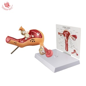 Modello utero organi riproduttivi femminili anatomia struttura patologica educazione anatomica - Product Image 6