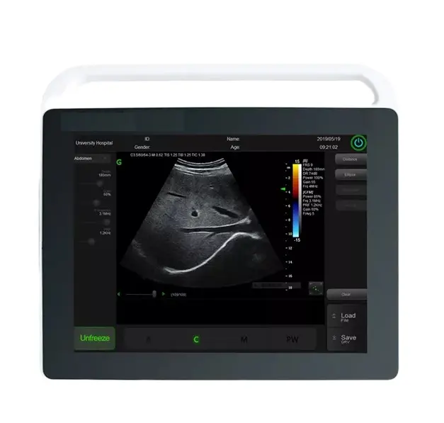 Mcvet scanner veterinário multilinguagem, poderoso 15 polegadas touch pad ultrassom com bom preço