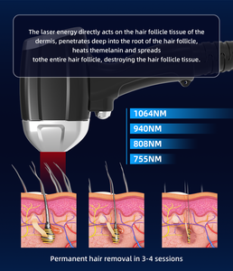 Boslaser Portable 1000W UV Disinfection <span class=keywords><strong>Diode</strong></span> Laser Bar 808 Ice Titanium Cube Appareil d'épilation 755nm 940nm Longueurs d'onde - Product Image 5