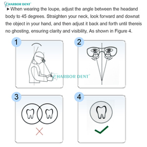 Occhiali Ingrandenti Dentali TTL 2.5X 3.5X con Lenti in Vetro Ottico, Distanza di Lavoro 320-420mm per Chirurgia in Clinica Dentale - Product Image 3