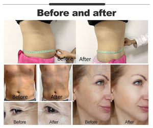 2 in 1 8 인치 터치 스크린 Tecar PEMF 448kHz 동물 근육 복구 및 통증 완화를위한 자기 치료기 - Product Image 4