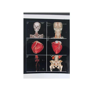 Deshiwe putih B Ultrasound Inkjet medis Film 210 Um PET tahan air kaku untuk Epson untuk printer - Product Image 4