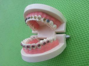 Dents dentaires orth modèles orthodontiques avec supports - Product Image 6