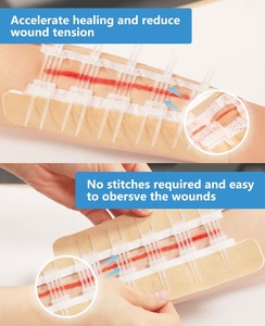 Dispositif de Fermeture de Plaie Stérile Couleur Peau de Haute Qualité, Très Vendu, pour Premiers Secours et Soins des Plaies - Zip Stitch - Product Image 5