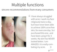 Vente en gros de produits de soin de la peau au curcuma cosmétiques nettoyage en profondeur Anti acné blanchissant kit de soin de la peau au curcuma avec crème de savon à l'huile