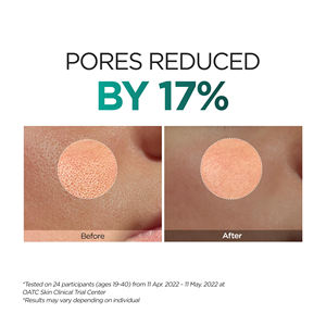 Nettoyant Visage Exfoliant au <span class=keywords><strong>Niacinamide</strong></span> Marque Blanche : Nettoyage des Pores, Élimination de l'Acné, Renforcement de la Barrière Cutanée, Équilibrage du Sébum - Product Image 5