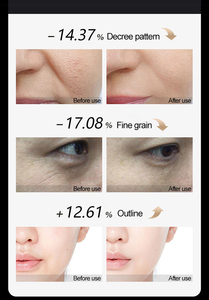 Meilleures ventes de l'année : Appareils de beauté à domicile pour revitaliser le collagène, raffermir et éclaircir la peau, avec contrôle précis et plus sûr de la température - Product Image 4