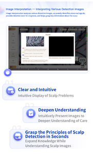 เครื่องวิเคราะห์หนังศีรษะแบบพกพาไร้สาย รุ่นใหม่ พร้อม AI และวัสดุ ABS ระบบตรวจจับหนังศีรษะด้วย AI - Product Image 4