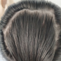 Perruque de Luxe à Capuchon en Soie avec Cheveux Humains Européens Vierge à Cuticules Alignées, Dessus en Soie, Lace Front, Perruques Médicales en Gros