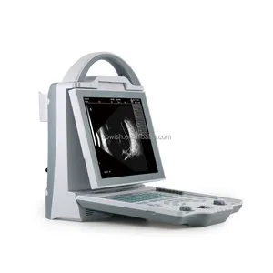 Ophthalmic AB scan ODU-5 Ultrasound A B Scan Optical Examination Ultrasound Scanner A/B scan