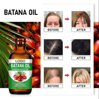 Minyak Batana 100% Organik Mempromosikan Pertumbuhan Rambut Perawatan Rambut Minyak Esensial