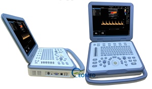 Escáner de Ultrasonido Canino y Felino CU30-2, Doppler Color Portátil para Veterinaria, Cardiología, Obstetricia, Abdomen, Vasos, Clínica, CU30-2vet - Product Image 1