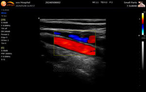 Laptop Full Digital Ultrasound Scanners Ultrassom Portátil Doppler Colorido - Product Image 4